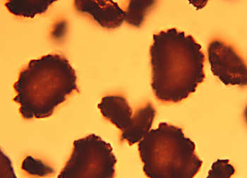 Oak Fern spores, Gymnocarpium dryopteris