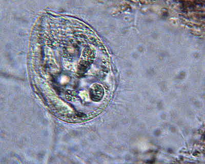 This protist is 100 microns across. Found in a drop of pond water from 